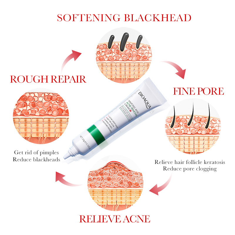 1/2/3 stücke BIOAQUA Salicylsä – Salicylic Acid Blackhead Remover Bewertung und Preis