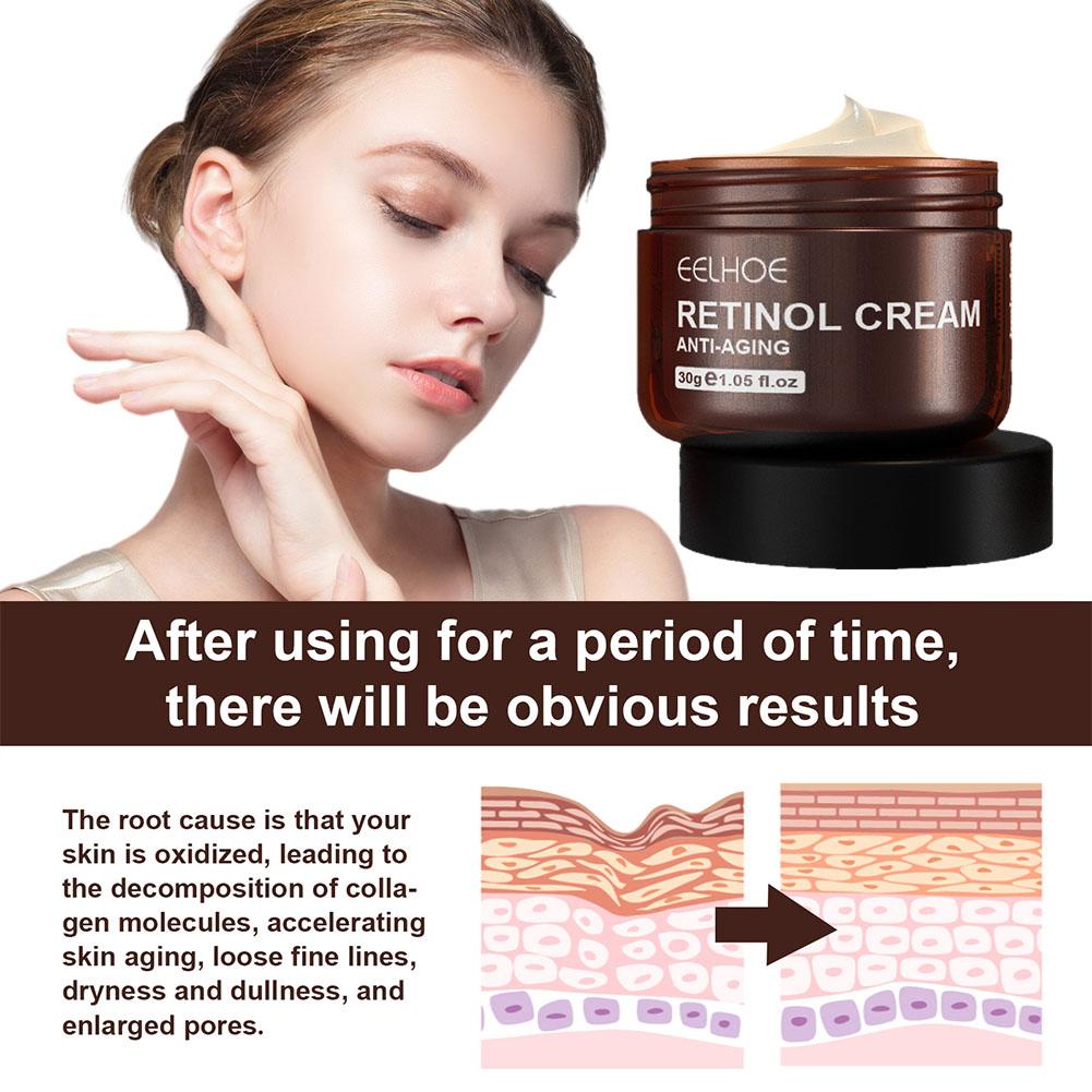 EELHOE 1/2/3/5 Stück (Kaufen S – Retinol Anti Wrinkle Cream Bewertung und Preis