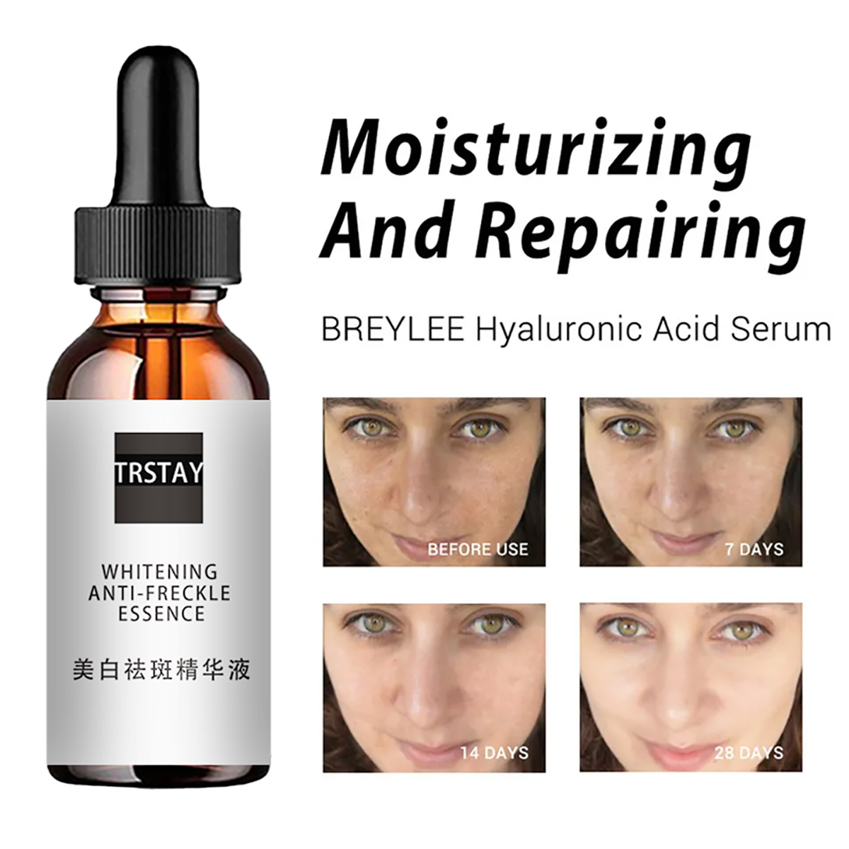Niacinamid Säure Gesichts Esse – Niacinamide Pore Shrinking Essence Bewertung und Preis