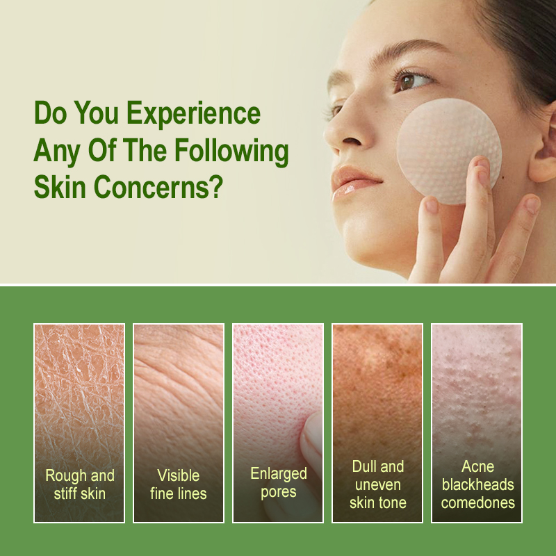 Salicylsäure-Peeling-Pads, Ölk – Salicylic Acid Blackhead Remover Bewertung und Preis