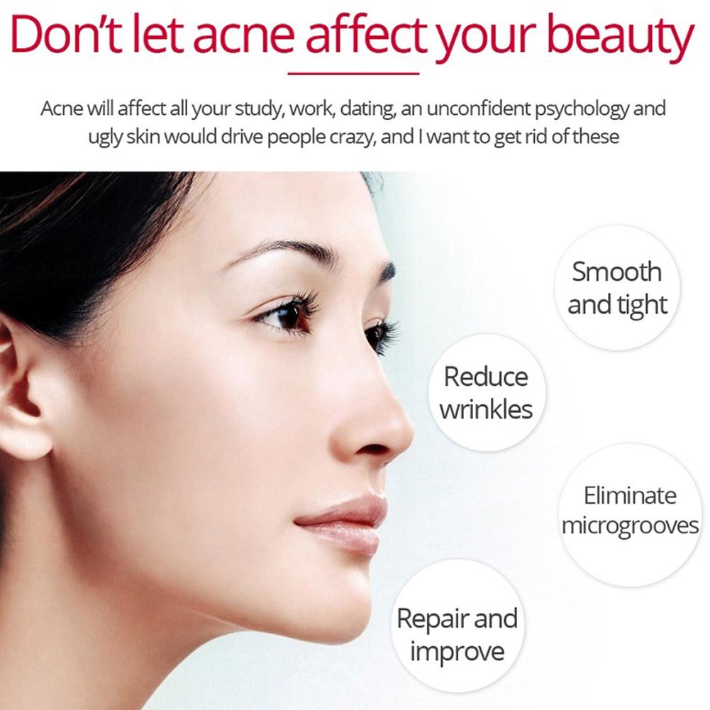 Retinol Lifting Straffende Cre – Retinol Anti Wrinkle Cream Bewertung und Preis